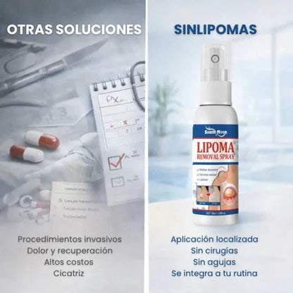 SinLipomas™ Spray Removedor de Lipmomas