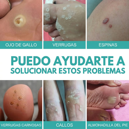 DermaTouch™ Lápiz Eliminador de Verrugas
