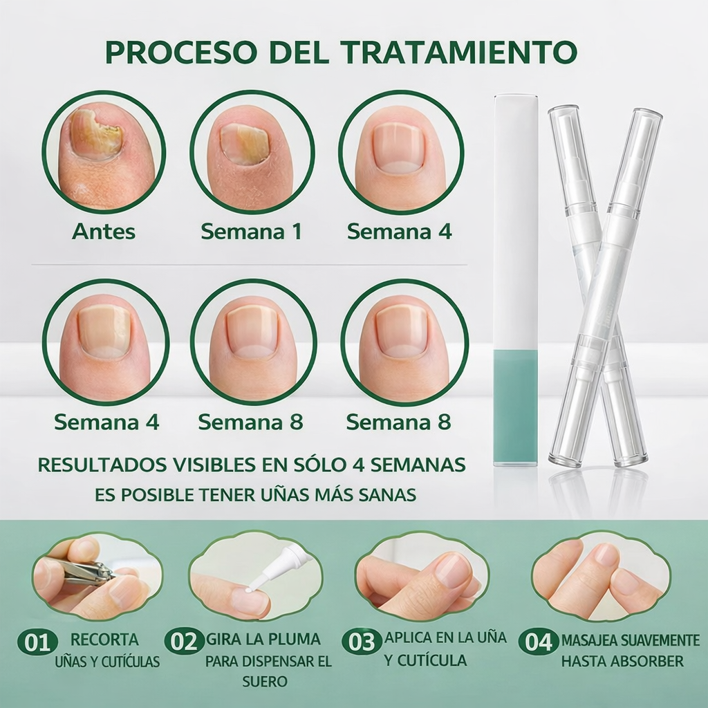 Una forma natural de eliminar los hongos en las uñas para siempre