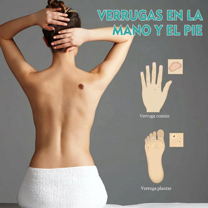 DermaTouch™ Lápiz Eliminador de Verrugas