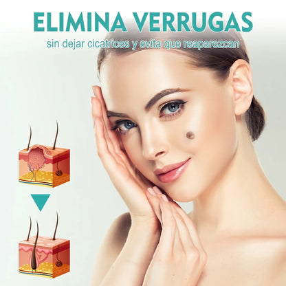 DermaTouch™ Lápiz Eliminador de Verrugas