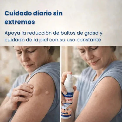 SinLipomas™ Spray Removedor de Lipmomas