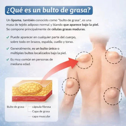 SinLipomas™ Spray Removedor de Lipmomas