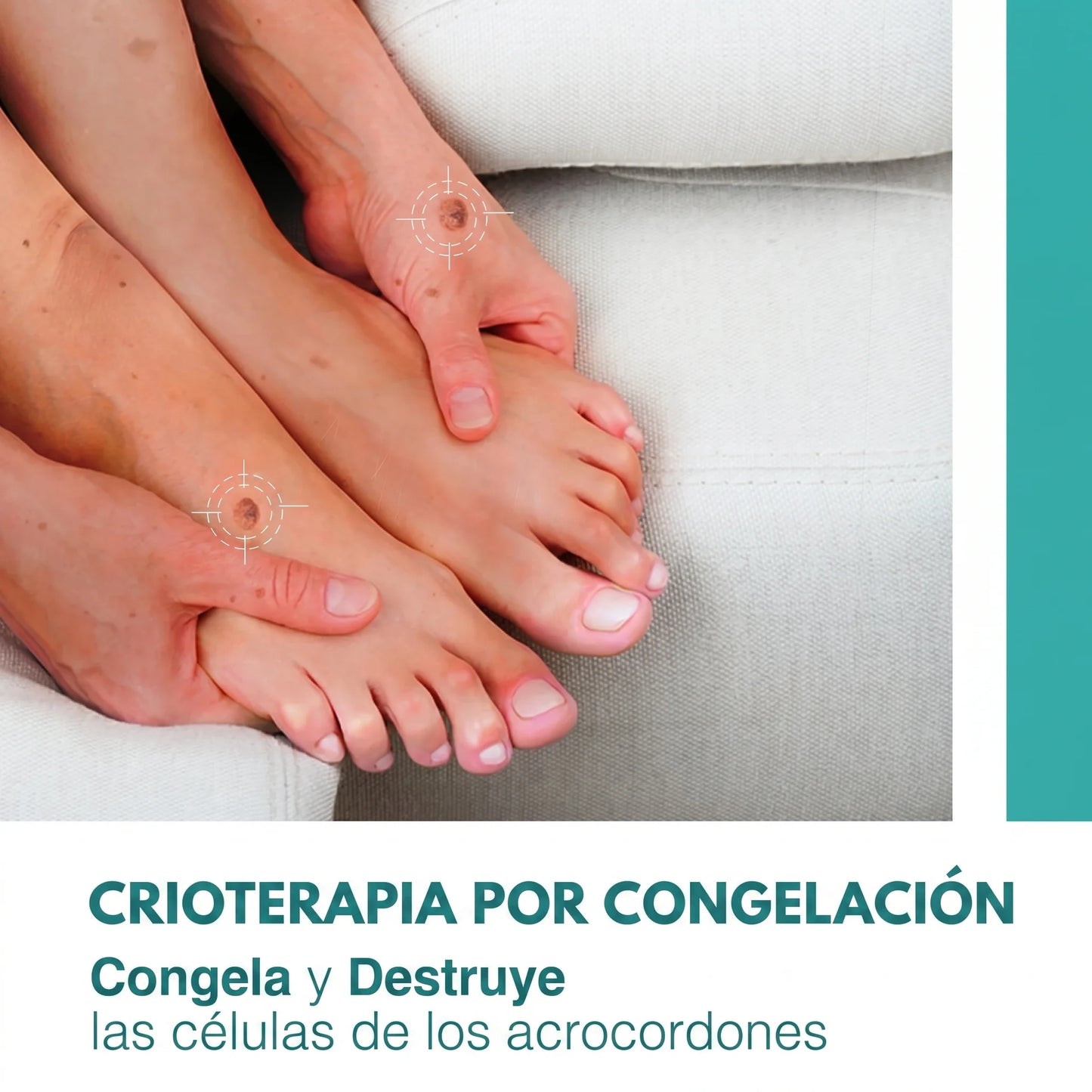 DermaTouch™ Lápiz Eliminador de Verrugas
